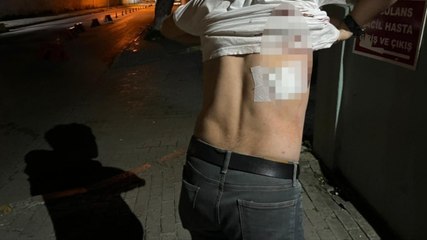 Taksi şoförüne makaslı saldırdı