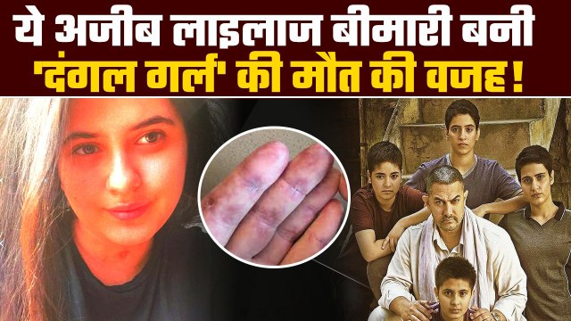 Suhani Bhatnagar Death: क्या है Dermatomyositis? इस बीमारी से 19 साल की उम्र में गई सुहानी की जान