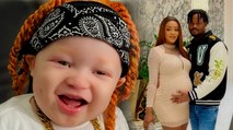 Black mum has albino baby born with ginger hair - and she dyes her own 