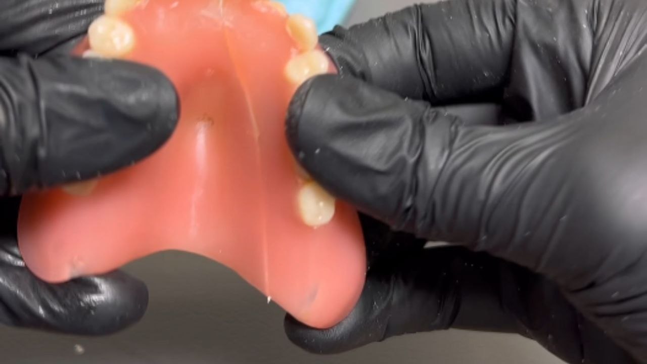 Dentist shows advancement in the dental technology by reconstructing gum and teeth