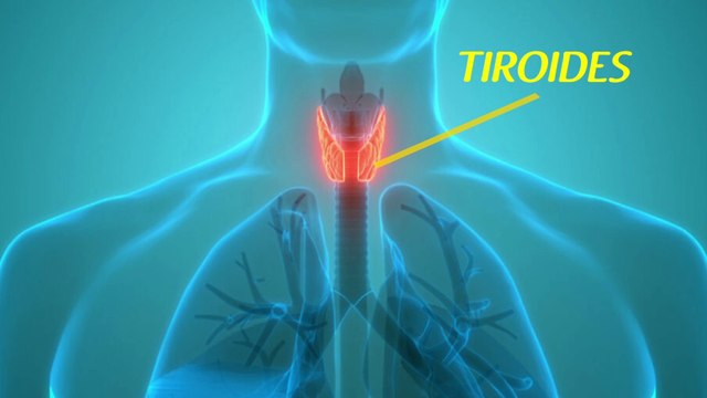 bd-causas-sintomas-tratamientos-de-tiroiditis-de-hashimoto-220224