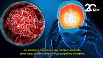 ¿Qué puede provocar un derrame o accidente cerebrovascular? - #EspecialMSP
