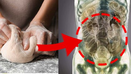 पेट में मैदा चिपकता है कि नहीं | आंत में मैदा चिपकता है कि नहीं | Boldsky