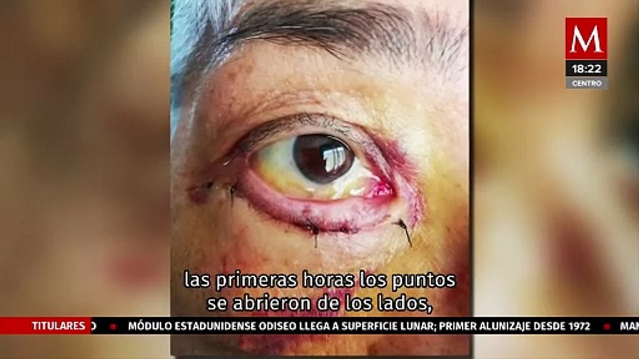 Víctimas de procedimientos estéticos denuncian a falsos cirujanos plásticos en Chihuahua