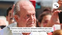 Plasma o ácido: todos los retoques estéticos que Juan Carlos I se ha hecho en el rostro, según Pilar Eyre