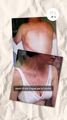 Ils ont été brûlés par la FOUDRE ?!