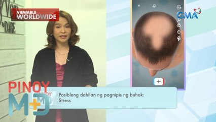 Pagnipis ng buhok, paano malulunasan? | Pinoy MD