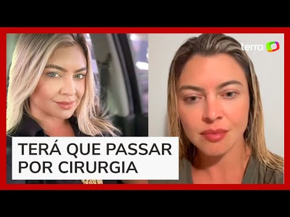 Delegada que levou tiro no pé de policial no DF afirma estar bem e agradece carinho