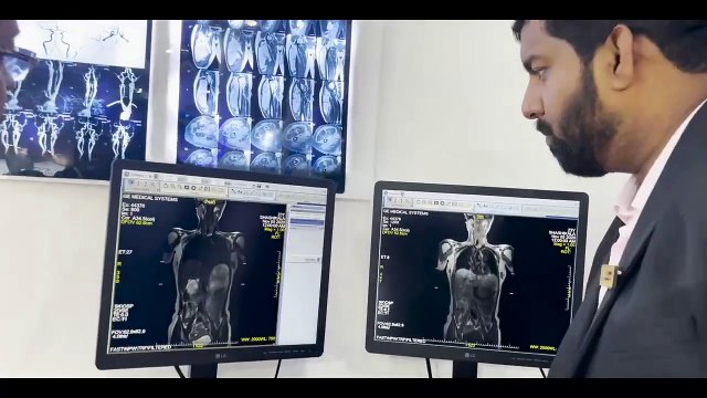 IRIA Exhibition __ Present Imaging Equipment Technology __ IRIA Radiology __ Phantom Healthcare