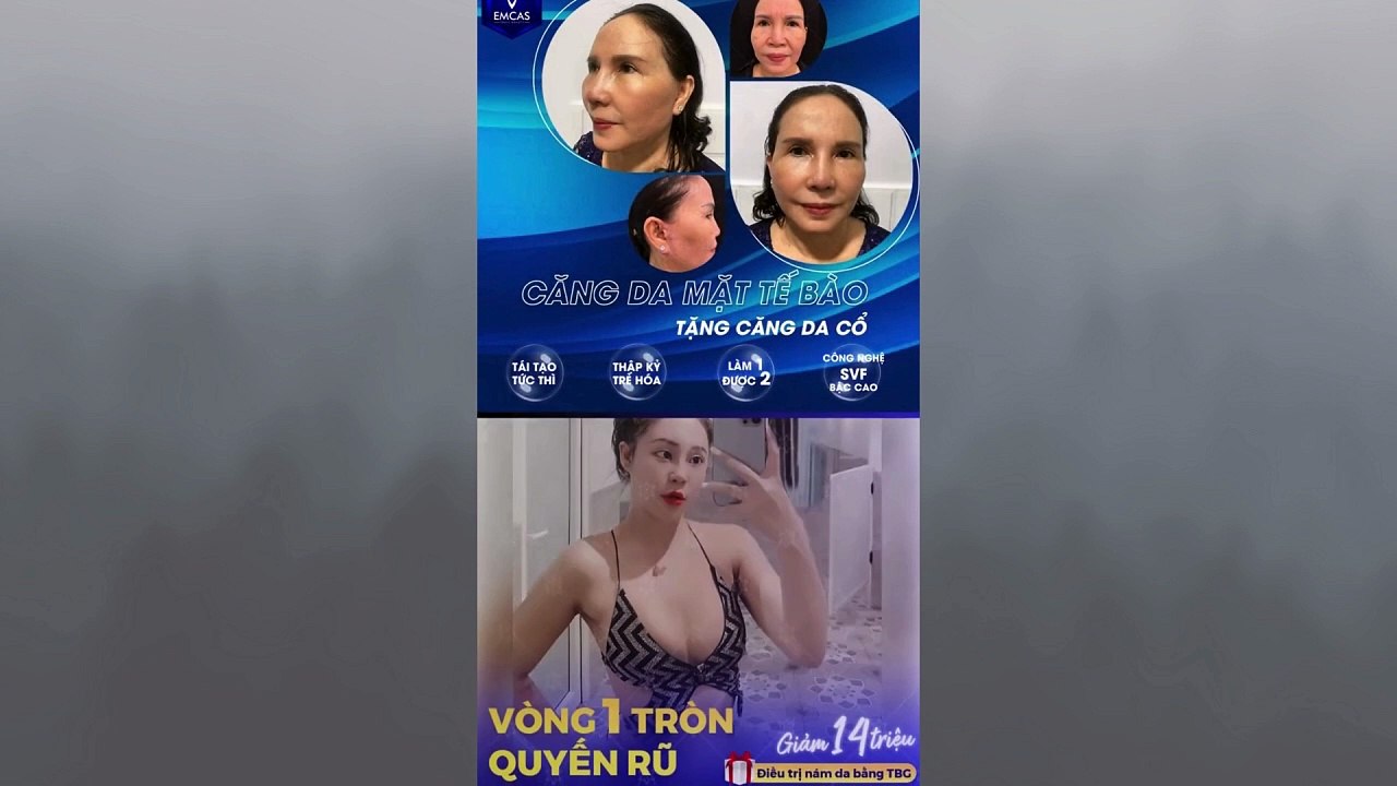 Tin Đồn Thẩm Mỹ Viện EMCAS Chết Người Và Sự Thật Ở Phía Sau