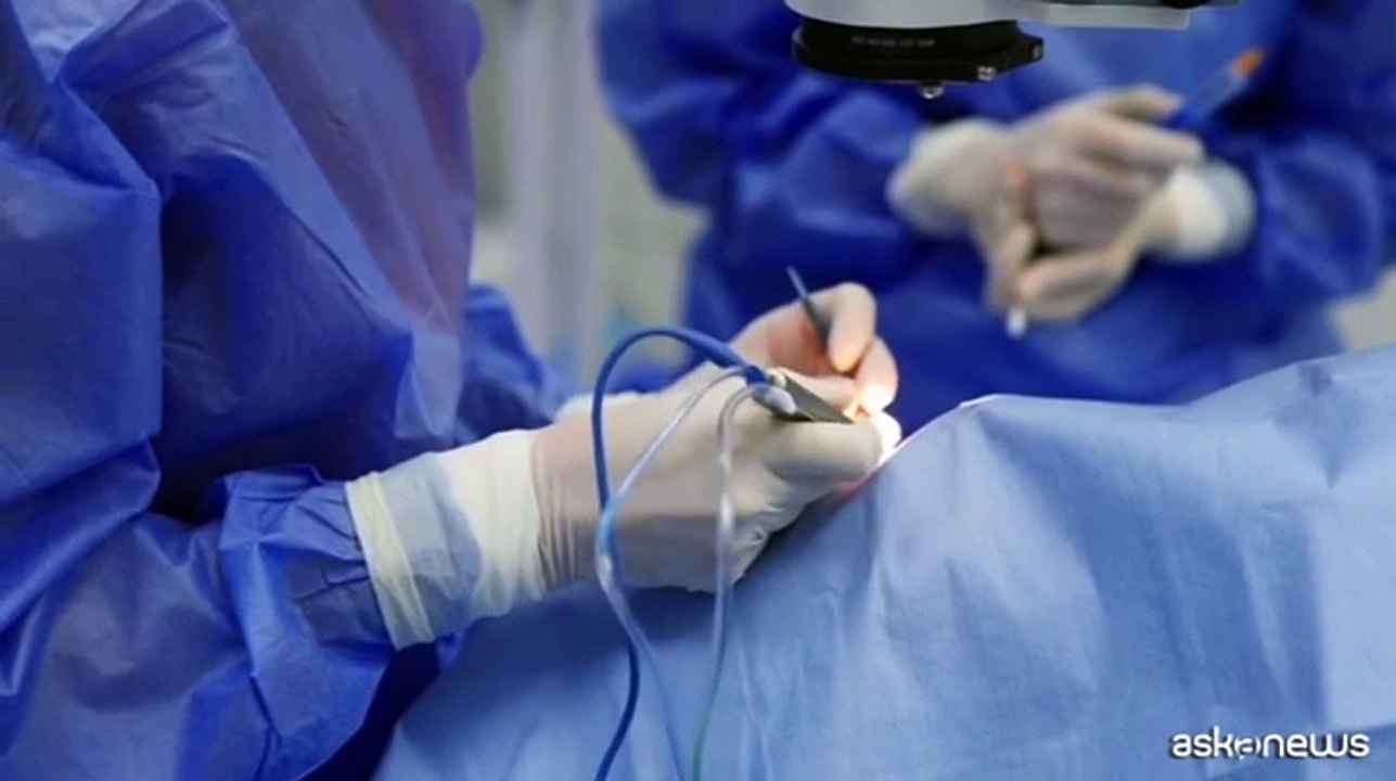 Per correggere la miopia l'impianto delle lenti intraoculari Icl
