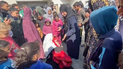 وفاة طفلة من ذوي الاحتياجات الخاصة في غزة بسبب سوء التغذية