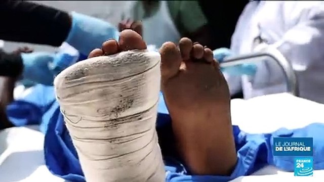 Est de la RD Congo : les civils blessés par les combats toujours plus nombreux