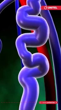 ¿Por qué salen las várices?, Estas son las causas y así puedes evitarlas