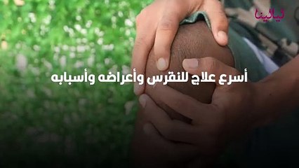 أسرع علاج للنقرس وأعراضه