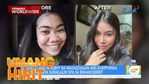 Dalagang nagpa-rhinoplasty para tumangos ang ilong, ating kilalanin! | Unang Hirit