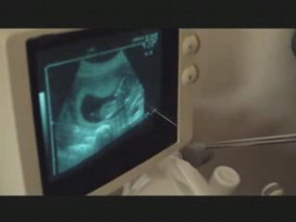 20080402_echo3_12SG