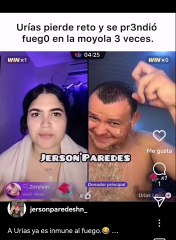 Urías Lobo se quema la cabeza tras perder reto con ‘Juanchi’