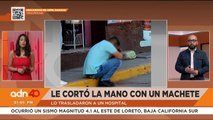 Le cortan la mano con machete a integrante de la Guardia Nacional