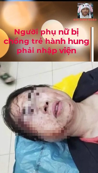 Người phụ nữ bị chồng bạo hành nhập viện trước ngày ly hôn