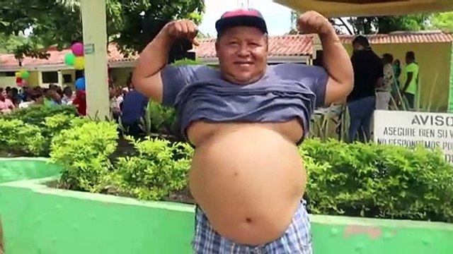 Mundo supera marca de mais de um bilhão de obesos