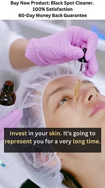 HOW TO GET RID OF DARK SPOTS | SKINCARE TIPS | ANTI AGING SKINCARE | BEAUTY TIPS