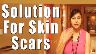 त्वचा के निशान के लिए घरेलु समाधान | Solution for Skin Scars By Priyanka Saini