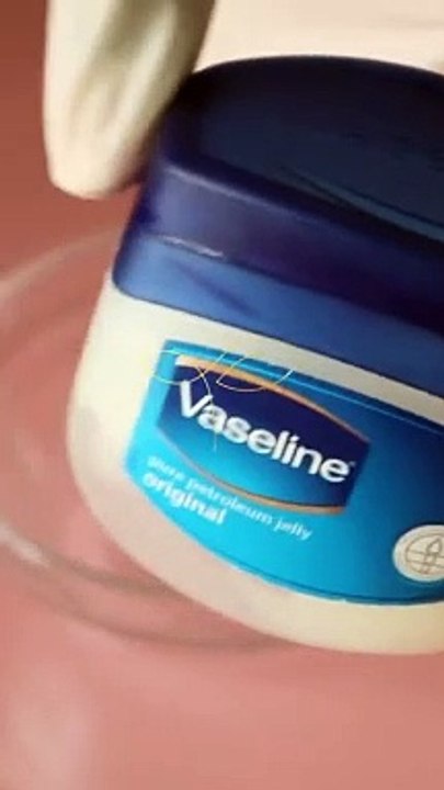 Utilisez cette crème maison si vous avez des vergetures