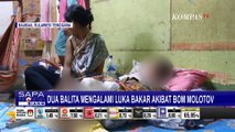 Karena Masalah Keluarga, 2 Balita Alami Luka Bakar Akibat Ledakan Bom Molotov!