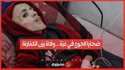 ضحايا الجوع في غزة...وفاة يزن الكفارنة بعد يوم واحد من تصويره