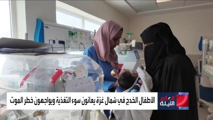 وفاة 15 طفلا من الخدج في مستشفى كمال عدوان بشمال غزة بسبب سوء التغذية
