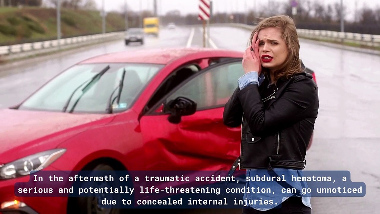 Subdural Hematoma After An Accident Signs to Watch Out For