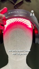 Cet Appareil Lutte Contre la Calvitie !