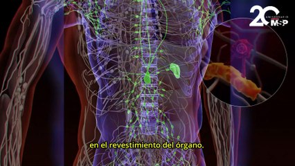¿Por qué sufrimos de apendicitis? - #EspecialMSP