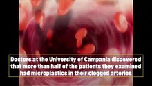 Heart surgeons find 58% of patients have plastic clogging arteries