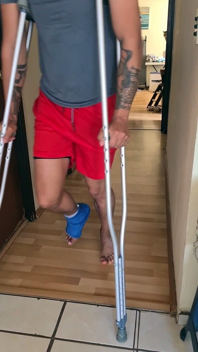 Copy Cat Mimics Human Using Crutches