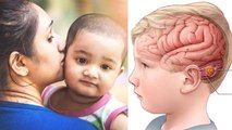 Dravet Syndrome In Babies Symptoms, Causes And Treatment In Hindi | Boldsky