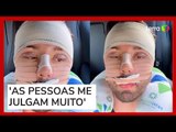 Rico Melquíades explica que fez cirurgia no rosto por 'não aguentar mais ser chamado de feio'