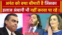 Anant Ambani को क्या बीमारी है जिसका इलाज Mukesh Ambani भी नहीं करवा पा रहे |Radhika |वनइंडिया हिंदी