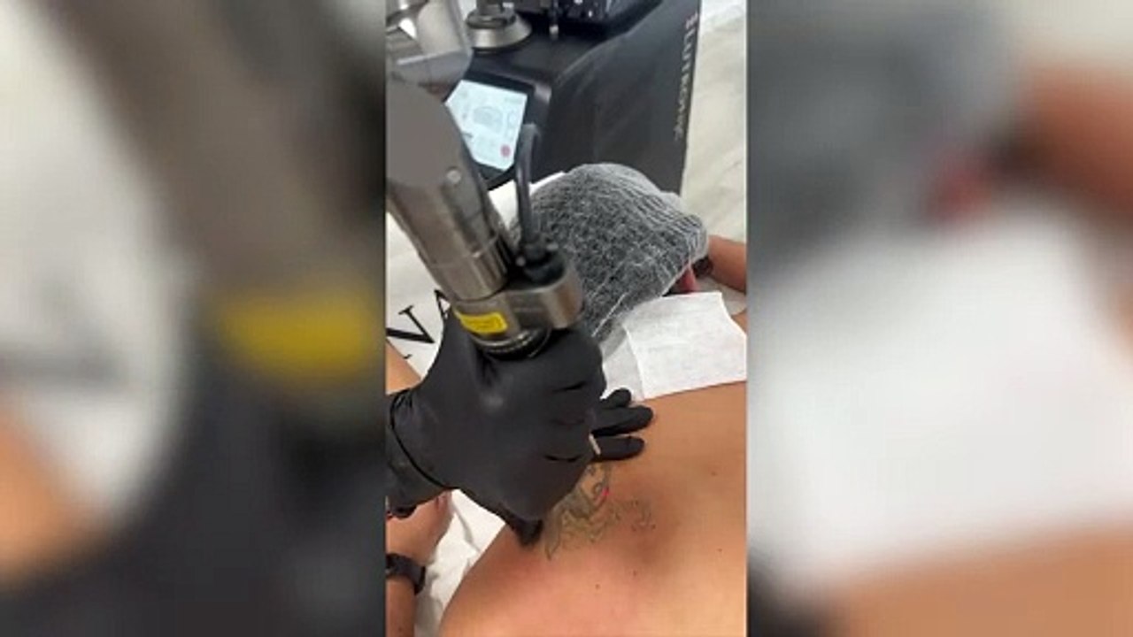 Tratamiento láser con paciente