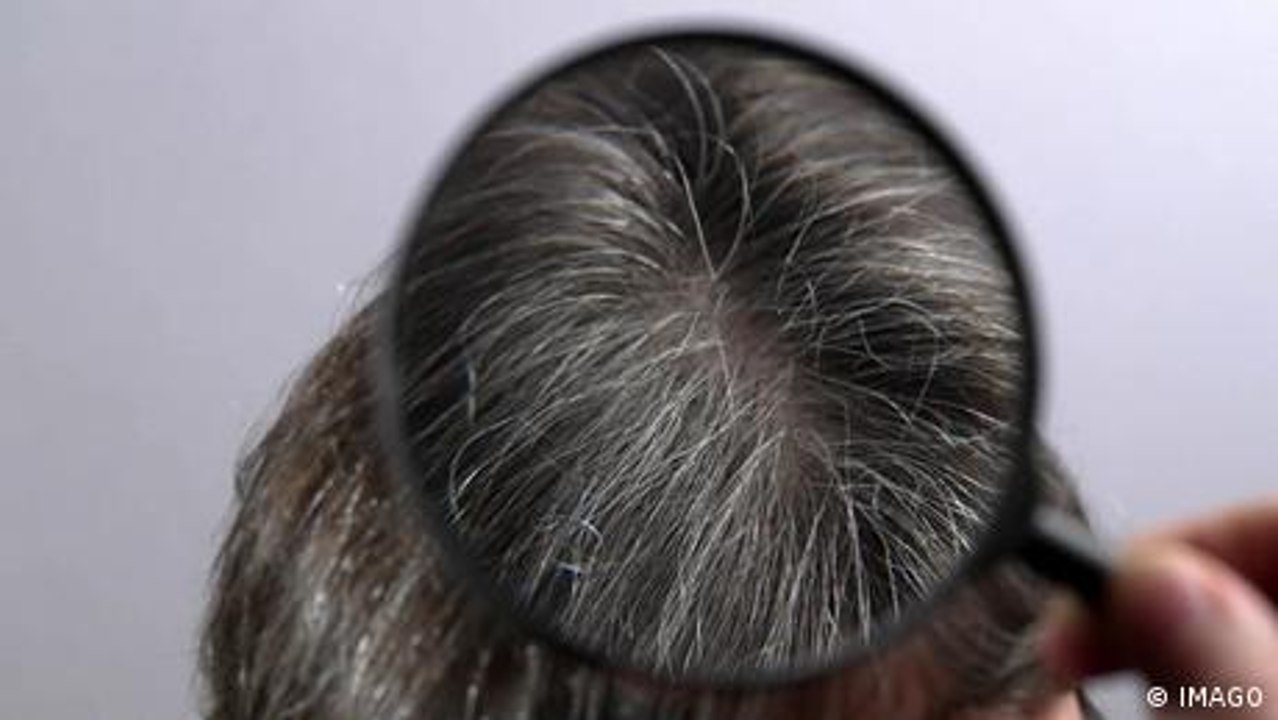 Warum bekommen wir graue Haare?