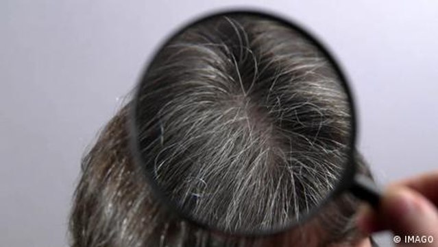 Warum bekommen wir graue Haare?