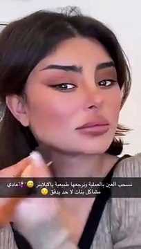 غدير السلطان في أول ظهور بعد خضوعها للتجميل