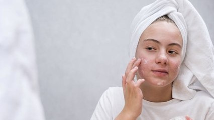 Sustancias Químicas Cancerígenas En Cremas Populares Contra El Acné