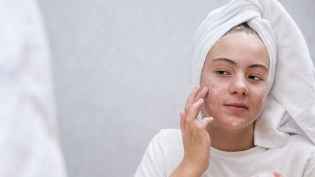 Sustancias Químicas Cancerígenas En Cremas Populares Contra El Acné