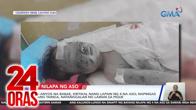 24 Oras Part 3: Batang nilapa ng 4 na aso; pamilyang nakatira sa kweba; Megan Young, nag-sorry; paglilinaw ni Rio Locsin sa nag-viral na pag-iyak sa set ng Black Rider , atbp.