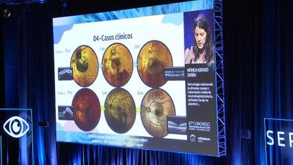 Más de 1.000 oftalmólogos de todo el mundo se reúnen en el Congreso Anual de la SERV