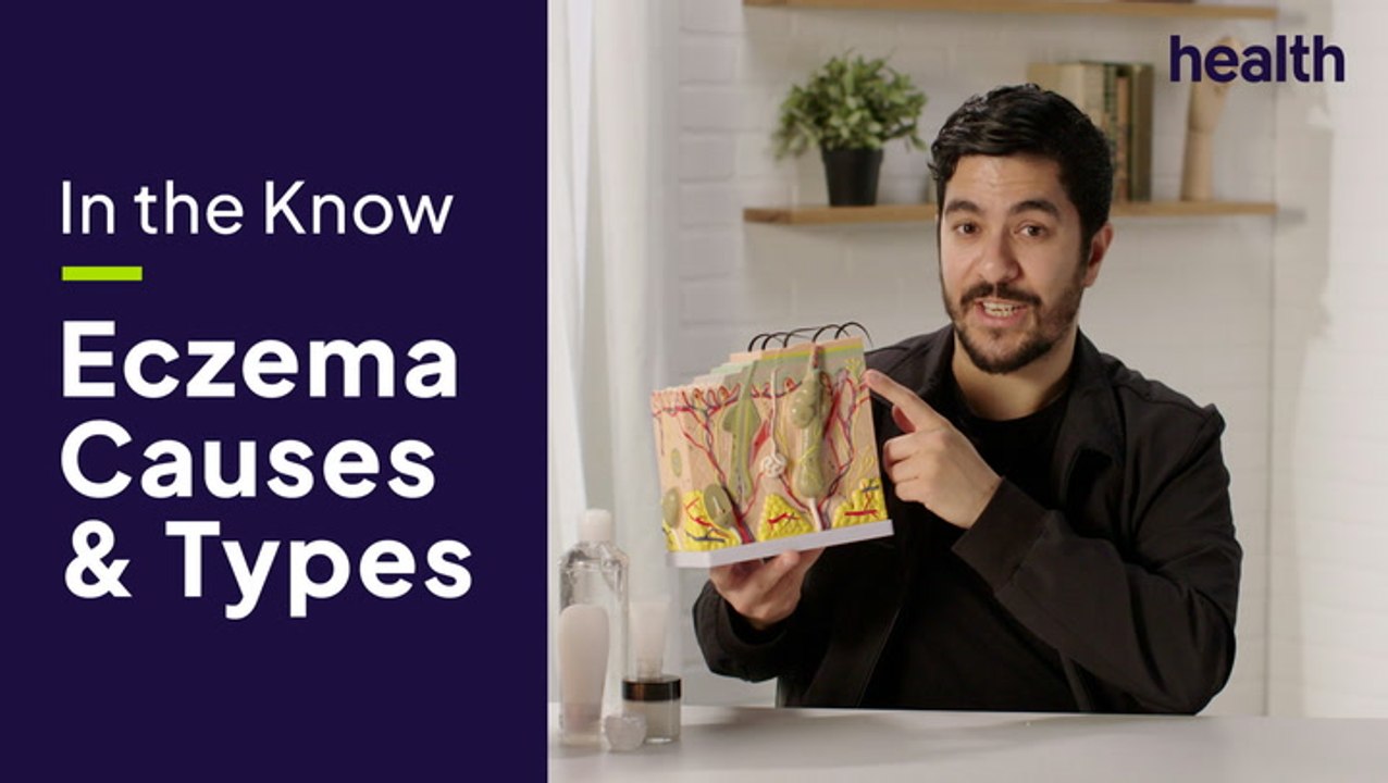 Eczema Causes and Types