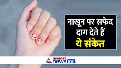 अंगुली के नाखून पर दिखे सफेद दाग तो ये हो सकता है धन लाभ का संकेत