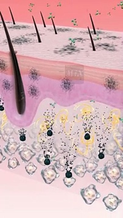 Blackheads | Causes of clogged pores #mix #blackheads_cause